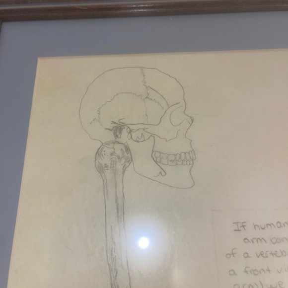 Framed Anatomy Art Spine Replaced With Arm Bone 21” x 13” Interesting Piece - Picture 9 of 9